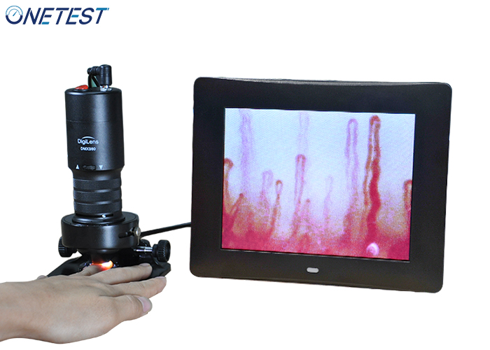 微循環(huán)血液檢測(cè)儀常見(jiàn)故障與解決方法