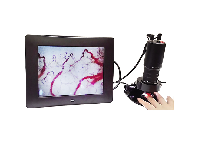 微循環(huán)血液檢測(cè)儀常見(jiàn)故障與解決方法